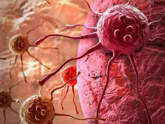 Signs of Cancer, Cancer Signs in body