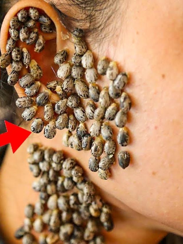 Most Dangerous insects in the World