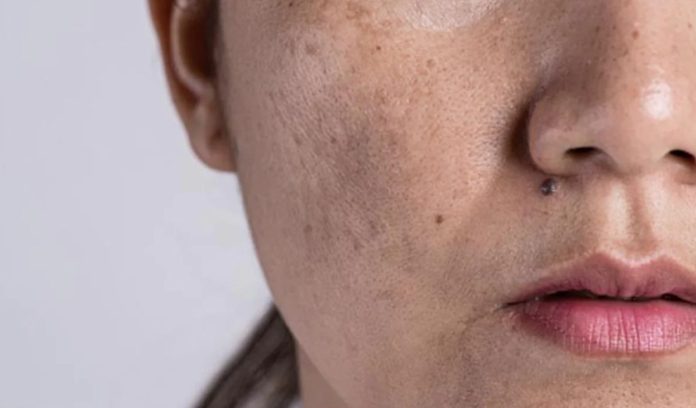 lack of vitamins lack of vitamins