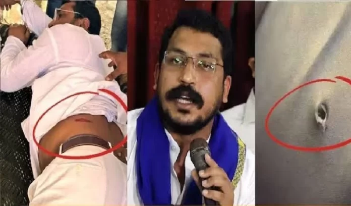 Who poisoned Chandrashekhar, Chandrashekhar Ravan Controversy