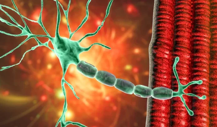 Guillain Barre Syndrome pune Guillain Barre Syndrome pune