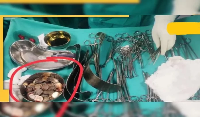 Man Eat Coins himachal pradesh news