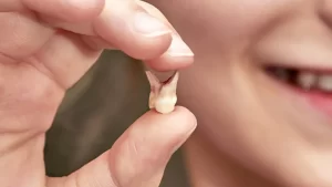 Teeth Breaking In Dream