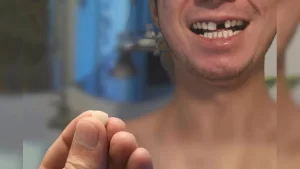 Teeth Breaking In Dream