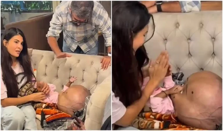 Jacqueline Fernandez News: बीमार बच्चे के लिए फरिश्ता बनीं जैकलीन फर्नांडिज़, सर्जरी ...